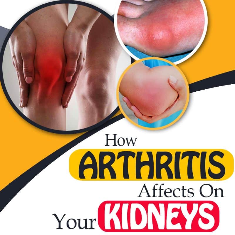 can-kidney-disease-cause-arthritis-arthritisdaily