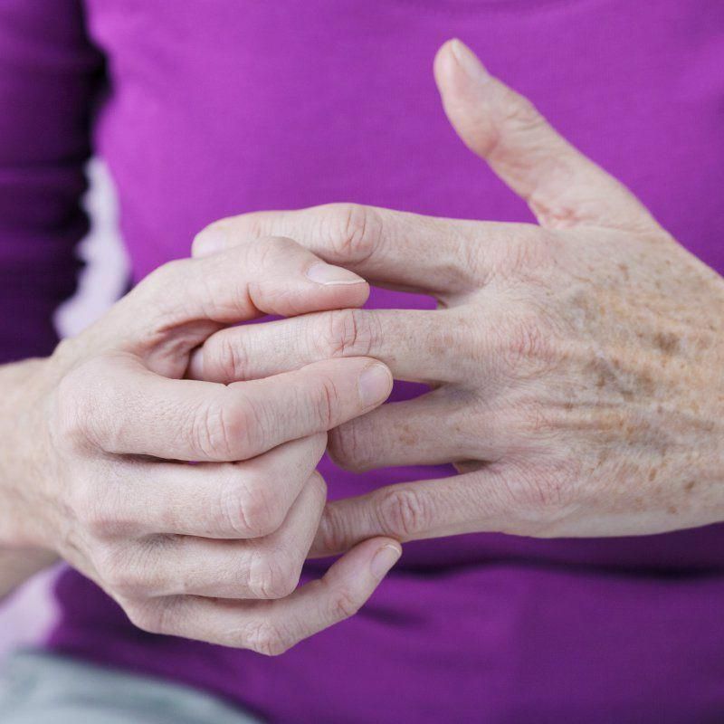 Psoriatic Arthritis: 7 Natural Ways to Relieve Symptoms