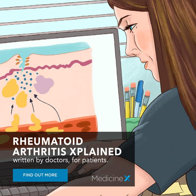 Rheumatoid Arthritis