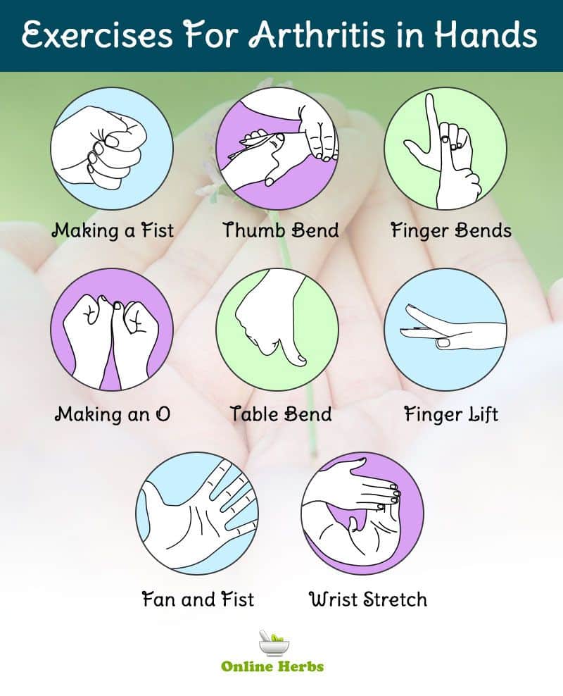 The 25+ best Arthritis hands ideas on Pinterest